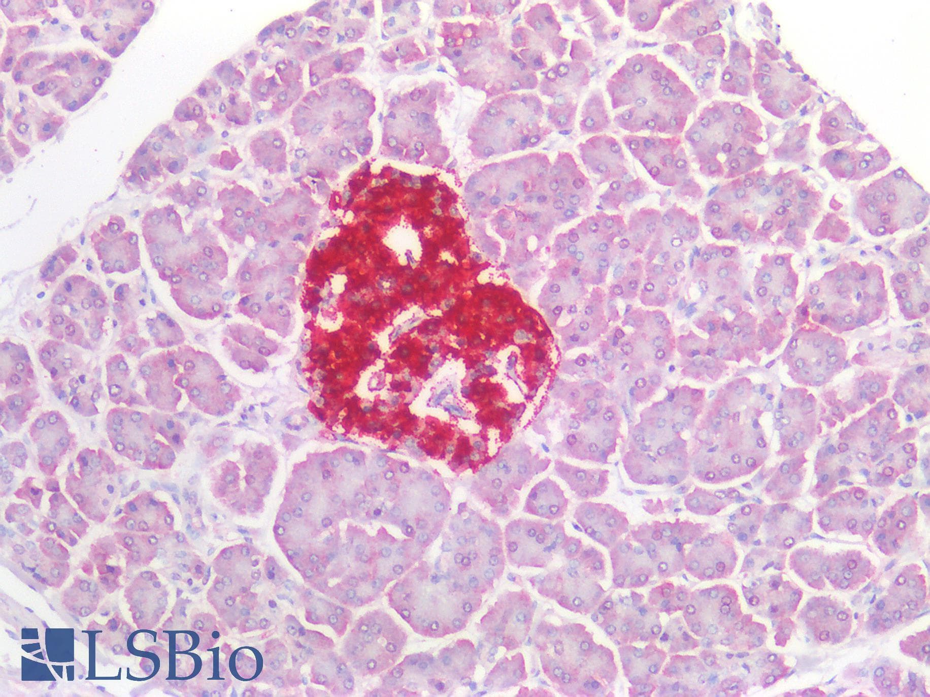 PathPlus™ Polyclonal Rabbit anti-Human TTR / Transthyretin Antibody (IHC)