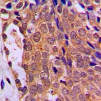 FOXO4 / AFX1 Antibody (Internal)