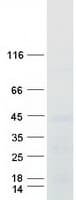 Human TRA2B / SFRS10 Protein (Recombinant Myc-DDK (Flag))