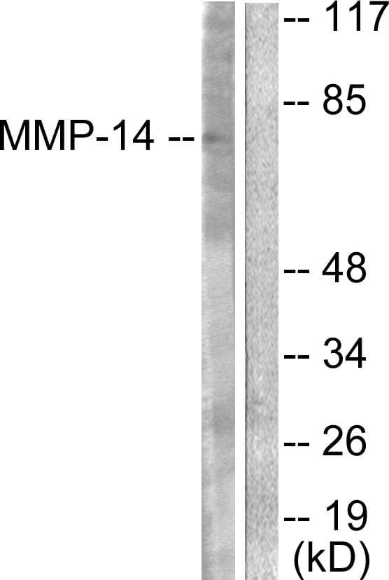 MMP14 Antibody