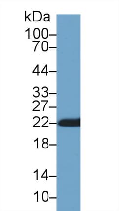PPIB / Cyclophilin B Antibody (aa34-216)