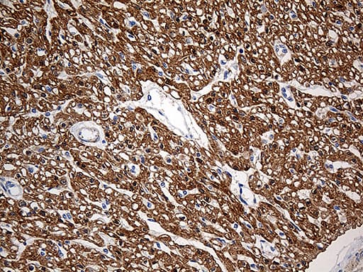 SH3BGR Antibody (clone OTI1G8)