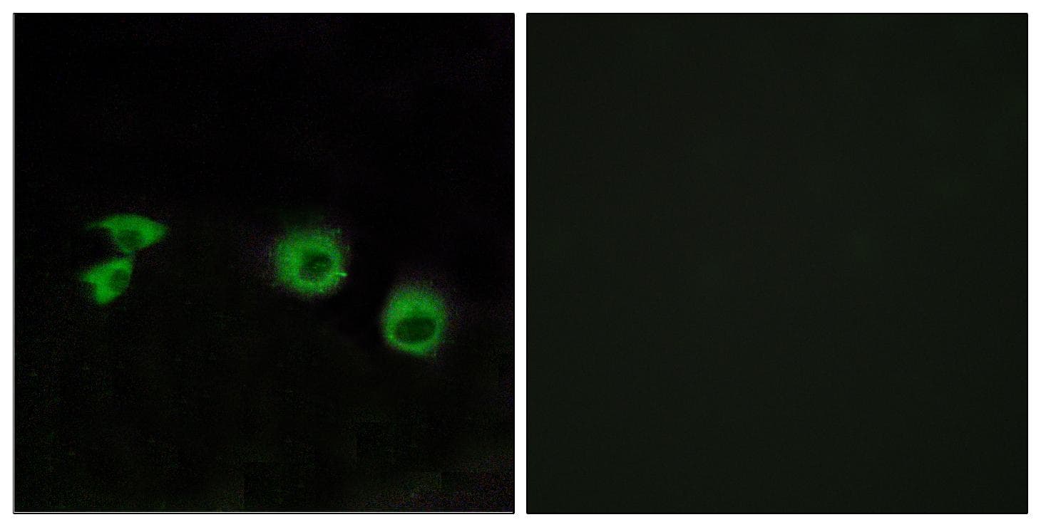 Polyclonal Rabbit anti-Human TRAF3IP1 Antibody (IHC, IF)