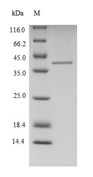 Human FTSJ1 Protein (Recombinant 6His, N-terminus)