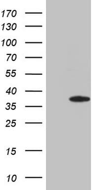 CSA / ERCC8 Antibody (clone OTI9B11)