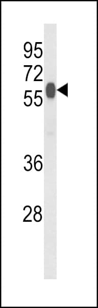 Polyclonal Rabbit anti-Human HACL1 Antibody (aa550-578, IHC, WB)
