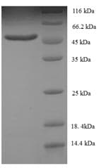 Human SMARCB1 / INI1 Protein (Recombinant 6His, N-terminus)