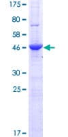 Human AMN1 Protein (Recombinant GST)