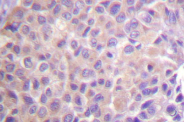 NFKBIE / IKB Epsilon Antibody (Asp17)