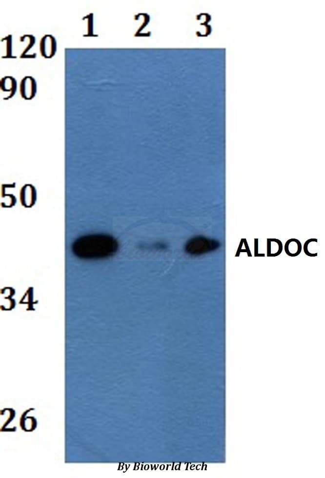 ALDOC / Aldolase C Antibody