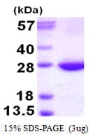 Human RAB31 Protein (Recombinant His)