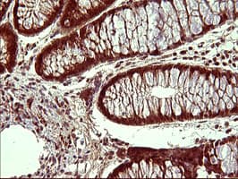 UPRT Antibody (clone OTI2F2)