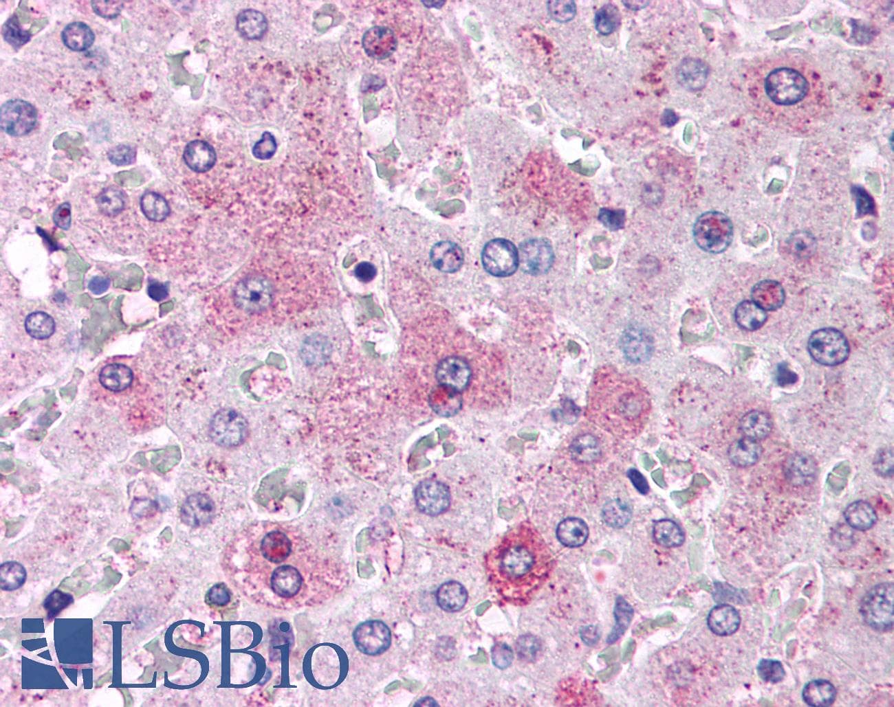 IHC-plus™ GCGR / Glucagon Receptor Antibody (C-Terminus)