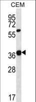 Polyclonal Rabbit anti-Human WNT16 Antibody (aa236-265, IHC, WB)