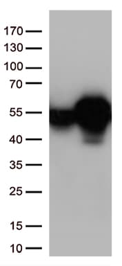CALR / Calreticulin Antibody (clone OTI15F5)