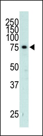ADRBK2 / GRK3 Antibody (aa633-660)