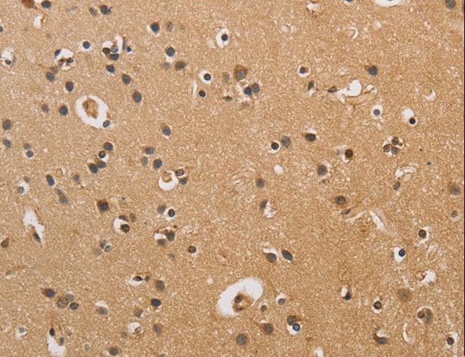 CST6 / Cystatin E/M Antibody