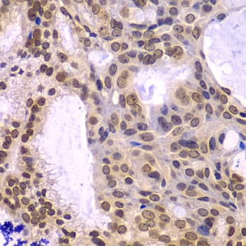 Polyclonal Rabbit anti-Human POLD3 Antibody (IHC, IF, WB)