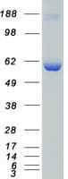 Human CAMKK1 Protein (Recombinant Myc-DDK (Flag))