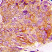 Polyclonal Rabbit anti-Human GSK3A / GSK3 Alpha Antibody (phospho-Ser21, IHC, IF, WB)