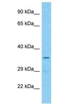 Polyclonal Rabbit anti-Human OR7E24 Antibody (aa217-266, WB)