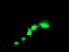IHC-plus™ TAGLN / Transgelin / SM22 Antibody (clone 8C8)