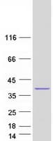 Human LDB3 / ZASP Protein (Recombinant Myc-DDK (Flag))