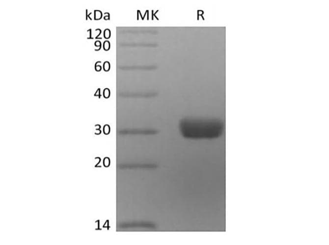 Human ANGPT2 / Angiopoietin-2 Protein (Recombinant 6His, C-terminus)