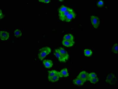 Polyclonal Rabbit anti-Human PTPRF Antibody (IHC)