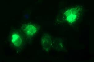 TGFB1 / TGF Beta 1 Antibody (clone OTI1E12)