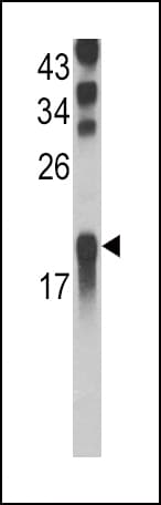 UBE2L3 / UBCH7 Antibody (aa1-30)