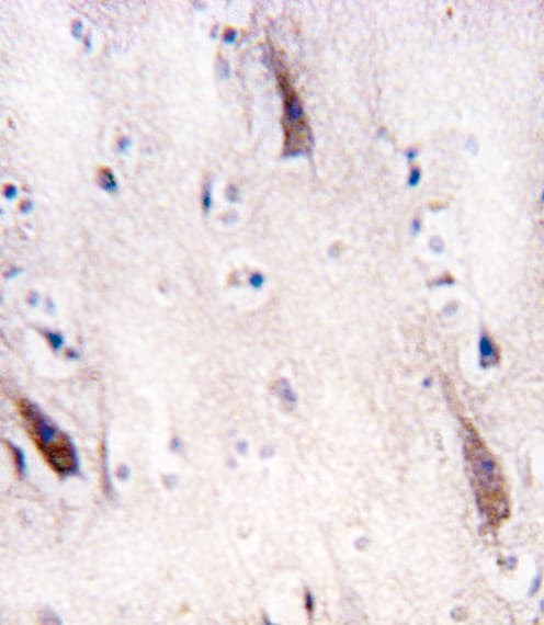 ULK2 Antibody (aa235-264)