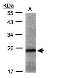 RAB2B Antibody (aa1-216)