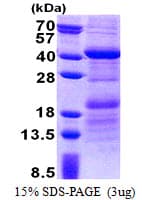 Human HEPACAM2 Protein (Recombinant His)