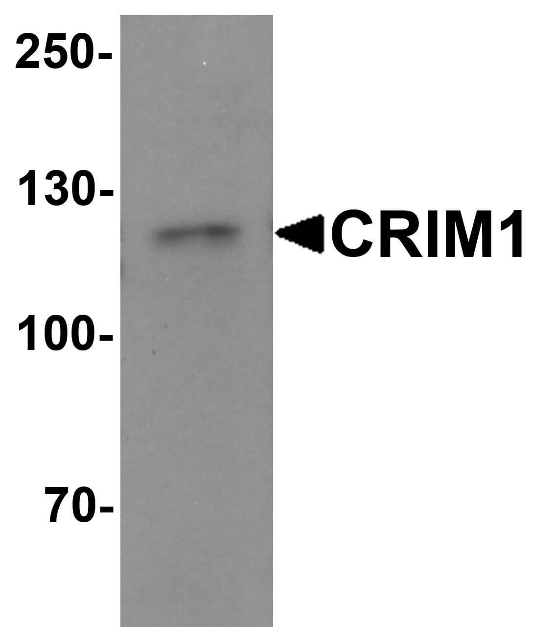 IHC-plus™ Polyclonal Rabbit anti-Human CRIM1 Antibody (IHC, IF, WB)