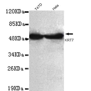 KRT7 / CK7 / Cytokeratin 7 Antibody (C-Terminus)