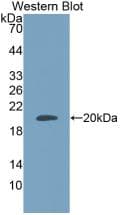 ADM / Adrenomedullin Antibody (aa22-147, Cy3)