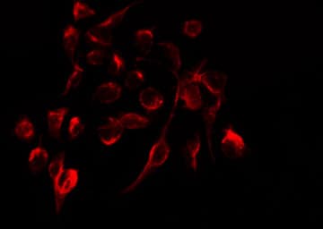 Polyclonal Rabbit anti-Human ITGB3 / Integrin Beta 3 / CD61 Antibody (phospho-Tyr773, IHC, IF, WB)