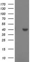 Monoclonal Mouse anti-Human SULT1C2 / Sulfotransferase 1C2 Antibody (clone OTI2F5, WB)