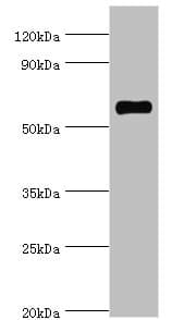 SRSF4 / SFRS4 Antibody (aa1-180)