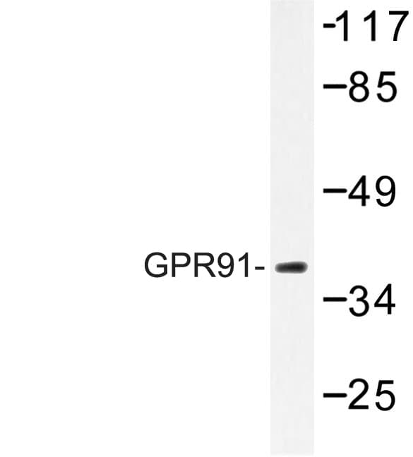 SUCNR1 / GPR91 Antibody (Ala135)