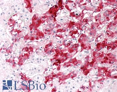 IHC-plus™ SERPINE2 / Nexin Antibody (clone 4E4)