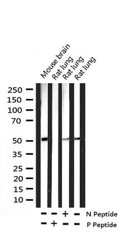 GSK3A / GSK3 Alpha Antibody (phospho-Ser21)