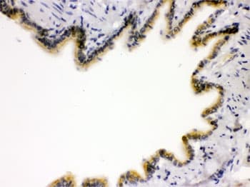 AGER / RAGE Antibody