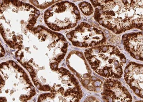 Polyclonal Rabbit anti-Human TRAP1 / HSP75 Antibody (IHC, IF, WB)