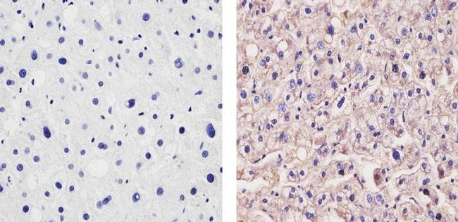APOA1 / Apolipoprotein A 1 Antibody (clone 6001)