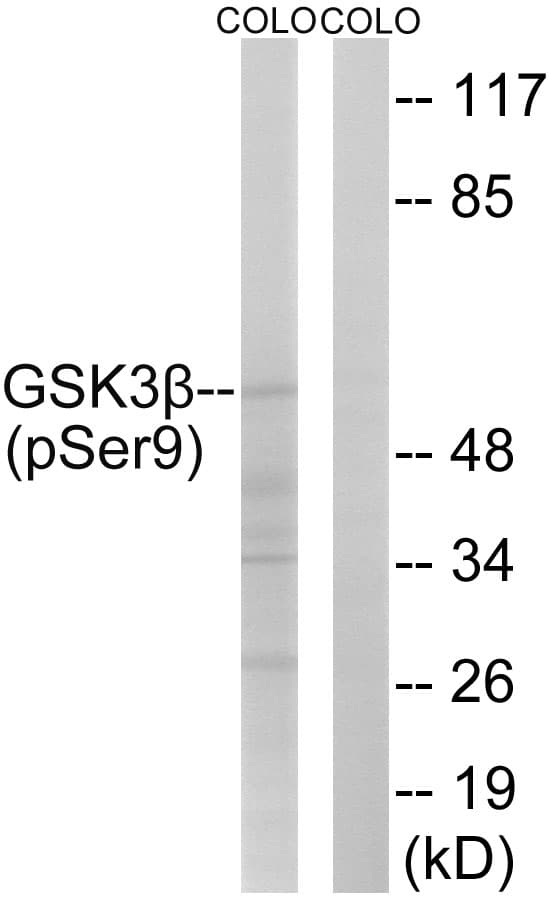 GSK3B / GSK3 Beta Antibody (phospho-Ser9)