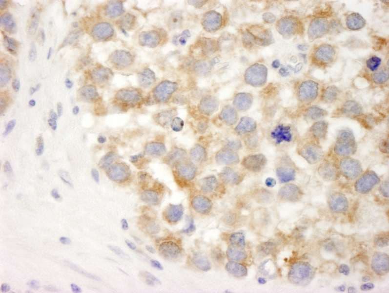 DDX3 / DDX3X Antibody (aa1-50)