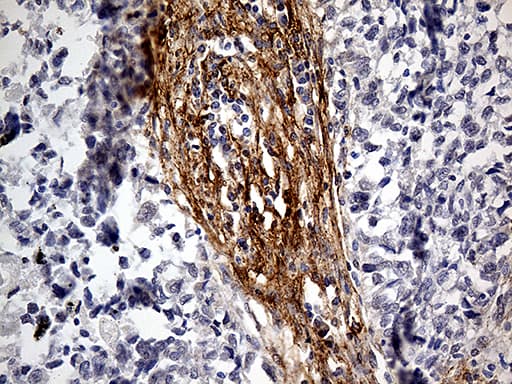 PDPN / Podoplanin Antibody (aa23-131, clone OTI3H5, Carrier-free)