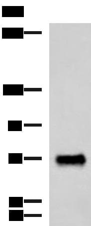 PPEF / PPEF1 Antibody